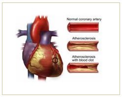 Slider image (3) Sahara Medical 